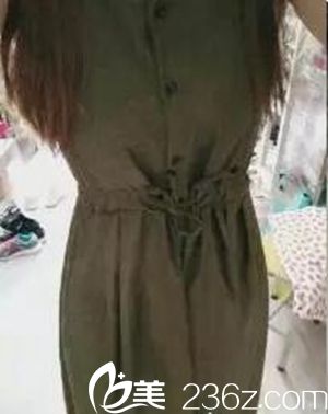 我在沈陽(yáng)茗湲做腰腹吸脂手術(shù)后1個(gè)半月.jpg 我在沈陽(yáng)茗湲做腰腹吸脂手術(shù)后1個(gè)半月.jpg