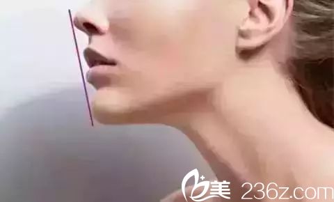 嘴唇自然緊閉，鼻尖唇珠下巴在一條線上
