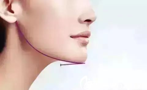 下巴下頜緣呈現(xiàn)流暢曲線