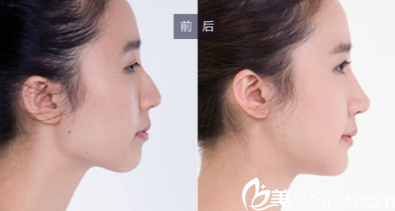 廣州美萊<!--<i data=20240703-sp></i>--><span style= 廣州美萊<!--<i data=20240703-sp></i>--><span style=