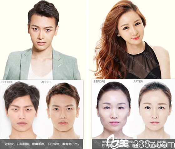 辛容元院長(zhǎng)的代表案例 辛容元院長(zhǎng)的代表案例