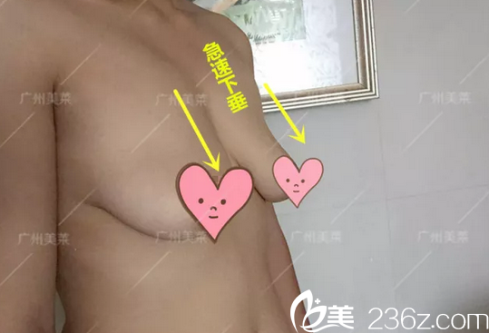 深圳富華醫(yī)療美容整形醫(yī)院唐新輝術(shù)前照片1