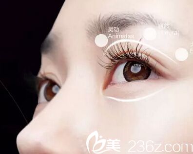 雙眼皮手術的成型階段