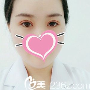 在衡水唯美花3670元做切開雙眼皮讓我擺脫小眼尷尬