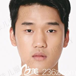 韓國(guó)珠兒麗整形醫(yī)院林炯佑術(shù)前照片1