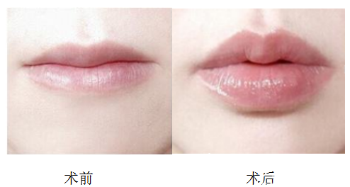 北京知音整形醫(yī)院案例