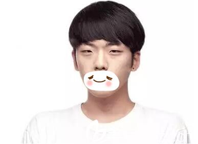 整形前栗子的樣貌 整形前栗子的樣貌