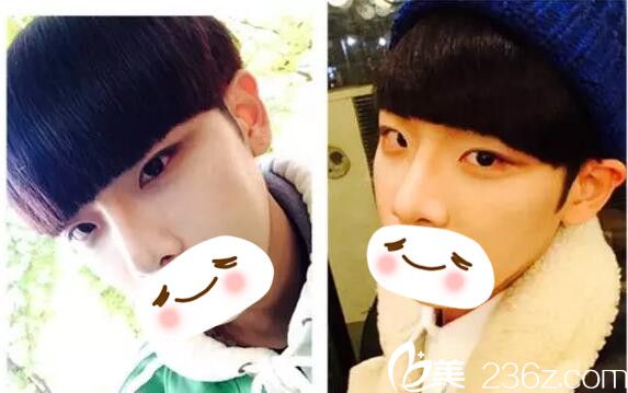 術(shù)后三個月恢復(fù)情況 術(shù)后三個月恢復(fù)情況