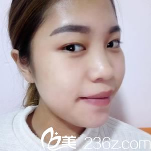 衢州芘麗芙醫(yī)療美容門(mén)診部彭愛(ài)芳術(shù)前照片1