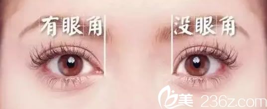 眼角對眼睛整體美觀的影響