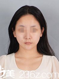 術(shù)前樣貌 術(shù)前樣貌