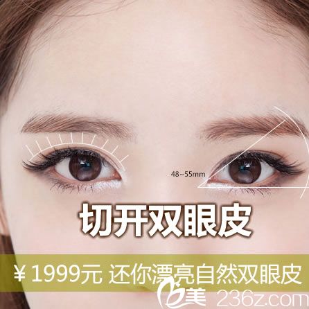 寧波壹加壹割雙眼皮優(yōu)惠活動 1999元起郭院長讓你3天變大眼