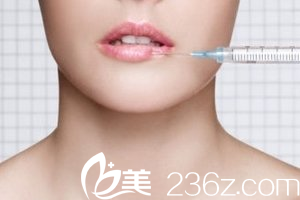 微笑唇的另一種手術(shù)方法注射法
