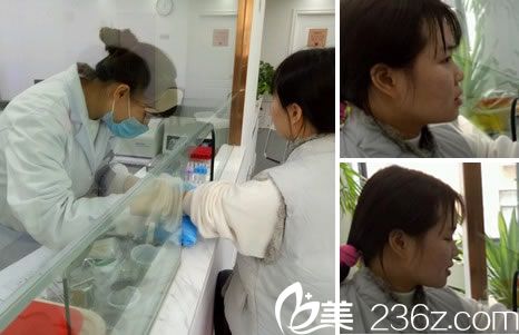 做鼻綜合手術(shù)前的常規(guī)檢查