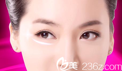 祛除眼袋一定要趁早