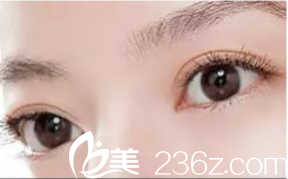 標準雙眼皮寬度