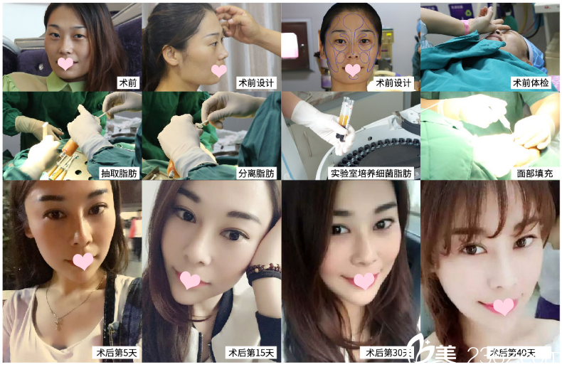 廣州廣美整形美容醫(yī)院案例展示