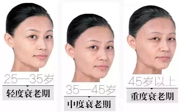 衰老是無時(shí)無刻循序漸漸的催蝕著容顏