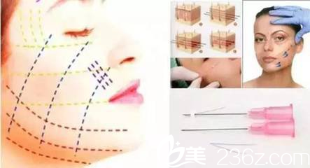 線雕是很符合如今當(dāng)代的潮流