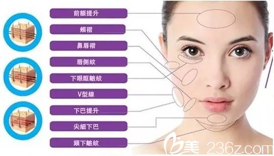 線雕的6大優(yōu)勢不容小看