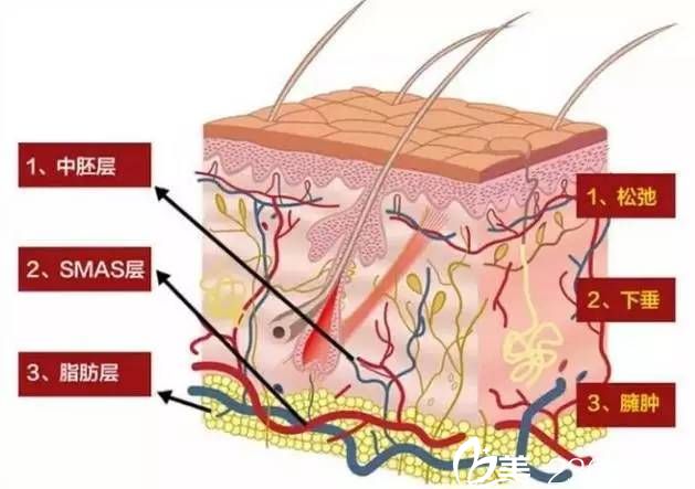 年紀(jì)越大做線雕的效果越好