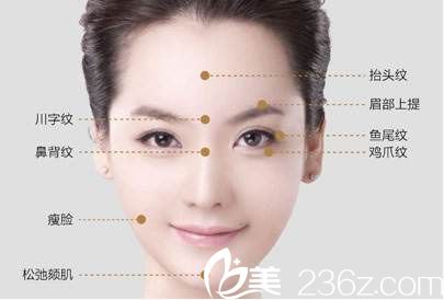 面部皺紋分布圖