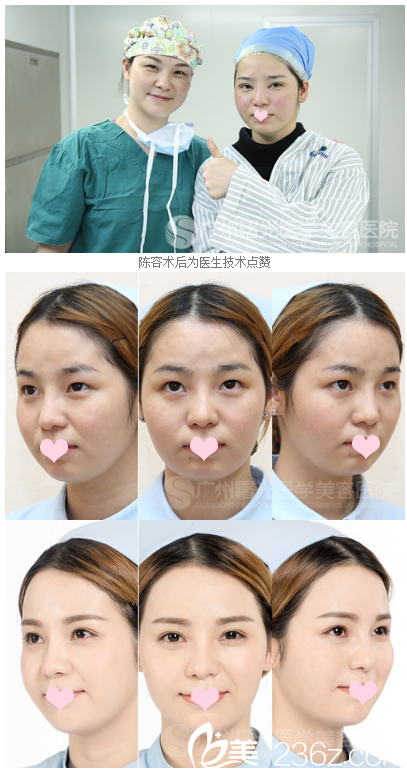 廣州曙光醫(yī)院做雙眼皮手術(shù)怎么樣