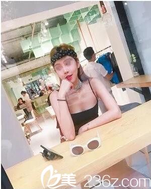 終于找到了能夠永葆青春的方法 就是武漢媄妲陳耀文做的面部線雕