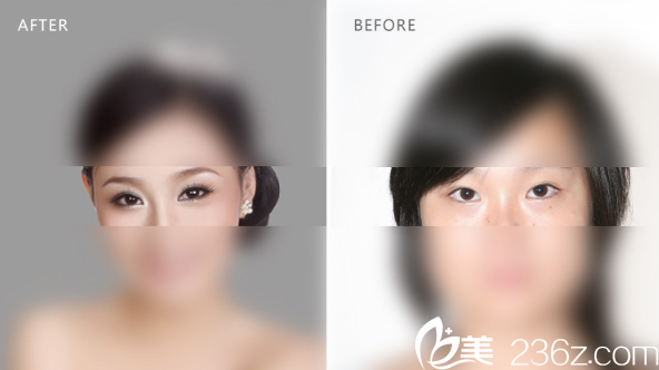 陳小劍醫(yī)生案例