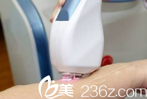 激光脫毛儀器 激光脫毛儀器