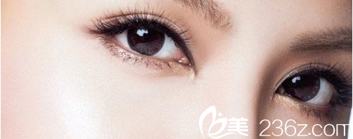 韓國(guó)清潭高端私人定制雙眼皮