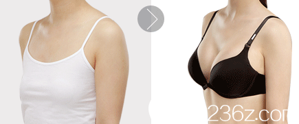 大同美神整形賈文隆胸案例 大同美神整形賈文隆胸案例