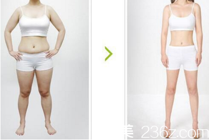 吸脂案例大同美神整形王賀宇 吸脂案例大同美神整形王賀宇