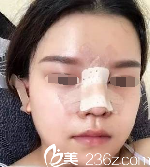 韓國will醫(yī)院鼻綜合手術