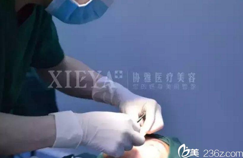 長沙協(xié)雅雙眼皮真人案例