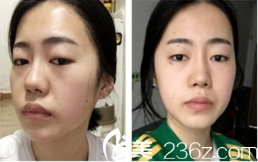 20171207_1512632606356941.png blob.png