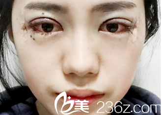 20171207_1512632611933775.png blob.png