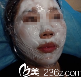 激光祛斑涂麻藥大同美神 激光祛斑涂麻藥大同美神