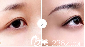 北京煤醫(yī)整形紋繡案例