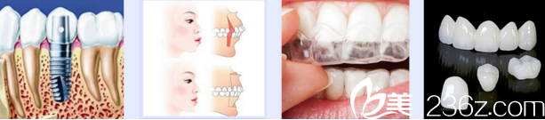 王宏偉醫(yī)生四大主打項目 王宏偉醫(yī)生四大主打項目