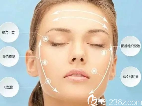 線雕所針對的面部問題