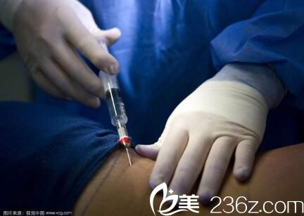 韓國(guó)Topclass整形外科鄭民宇麻醉 韓國(guó)Topclass整形外科鄭民宇麻醉