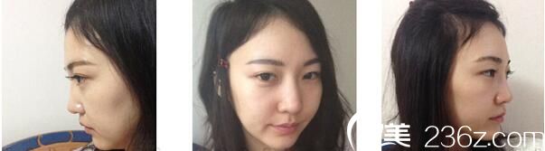 20171214_1513221974337170.jpg 20171214_1513221974337170.jpg