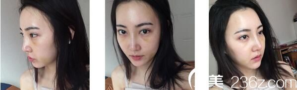 20171214_1513221987104403.jpg 20171214_1513221987104403.jpg