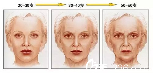 隨著年齡的增長，面部皺紋越來越深