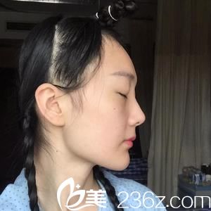 杭州整形醫(yī)院唐冬生術(shù)前照片1