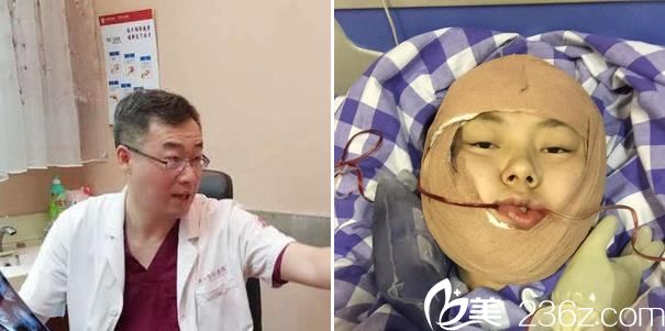 下頜角手術(shù)完成當(dāng)天照片 下頜角手術(shù)完成當(dāng)天照片