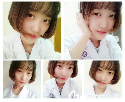 廣州藝美張濤全切雙眼皮案例15天自拍 廣州藝美張濤全切雙眼皮案例15天自拍