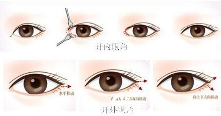 韓國VIEW必嫵整形醫(yī)院金正敏