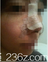 韓國(guó)藝德雅整形外科案例 韓國(guó)藝德雅整形外科案例